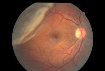 C:\My Documents\rd.Rt.jpg